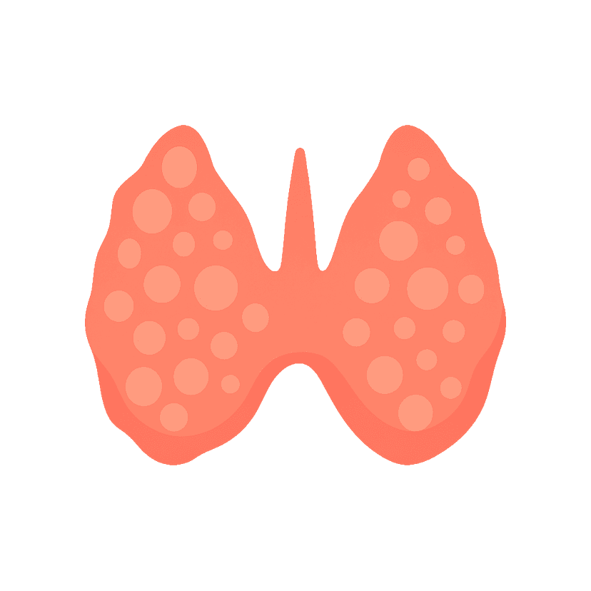 Artistic Thyroid